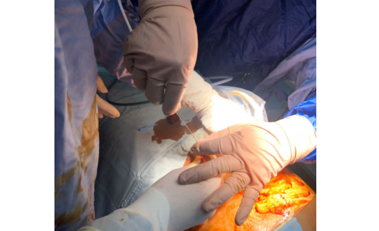 Diagnostic procedure
